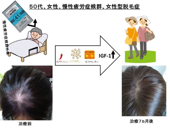 円形脱毛症　病院